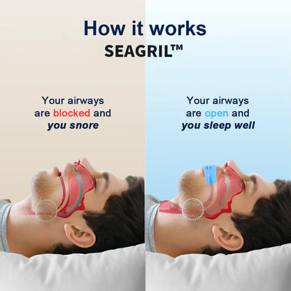 Ends Today: 70% OFF! SEAGRIL™Professional intelligent anti-snoring device